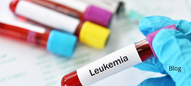 The Connection between Down Syndrome and Leukemia